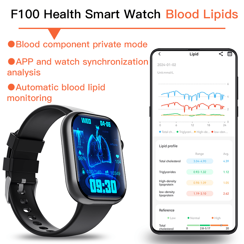 Best ECG Smart Watch of 2025 With Blood Pressure Monitor+Blood Glucose Monitoring - SHOP PAGUE AO CHEGAR smart watchWautton Outdoor Gear
